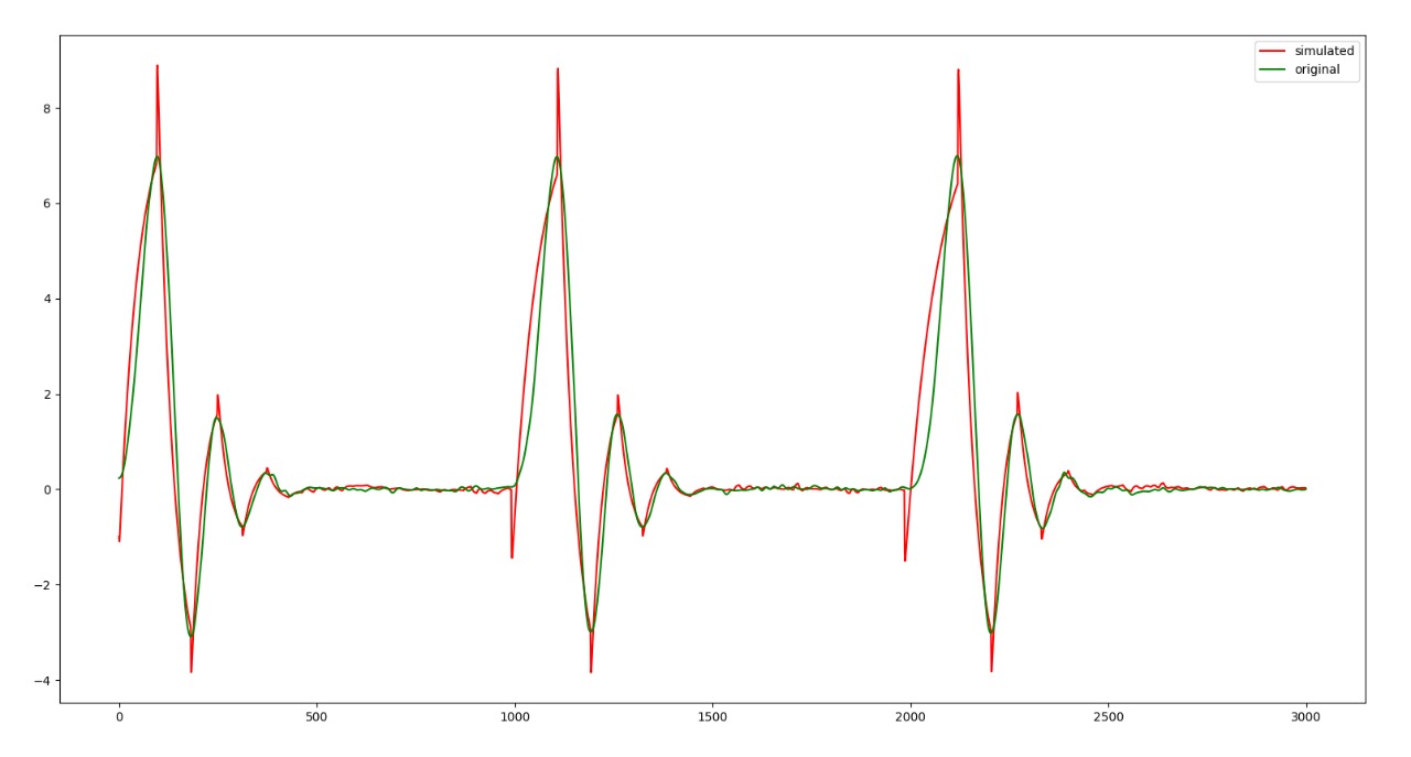 Simulating a ECG signal using the PID Simulator